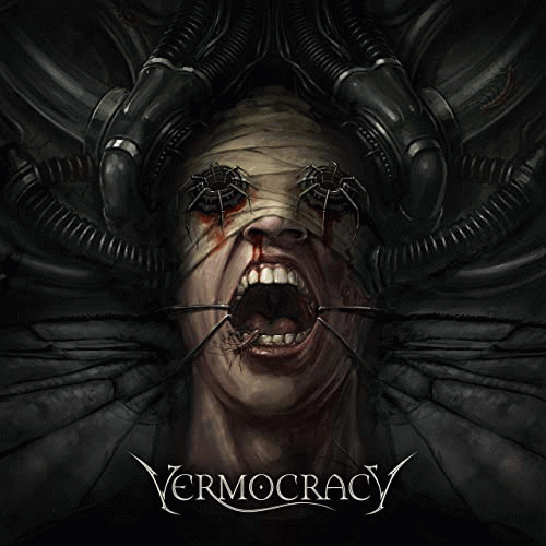 Vermocracy
